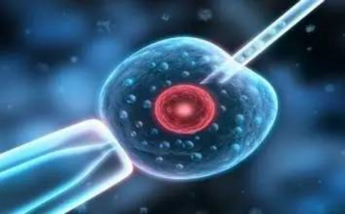 抗精子抗体不育